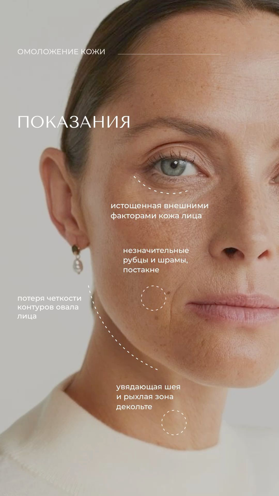 Anti-age уход - показания
